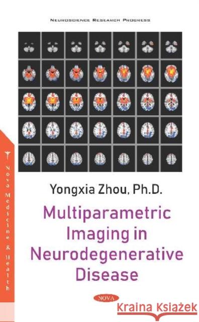 Multiparametric Imaging in Neurodegenerative Disease Yongxia Zhou   9781536153385 Nova Science Publishers Inc - książka