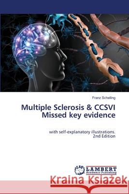 Multiple Sclerosis & CCSVI Missed key evidence Schelling, Franz 9786207473151 LAP Lambert Academic Publishing - książka