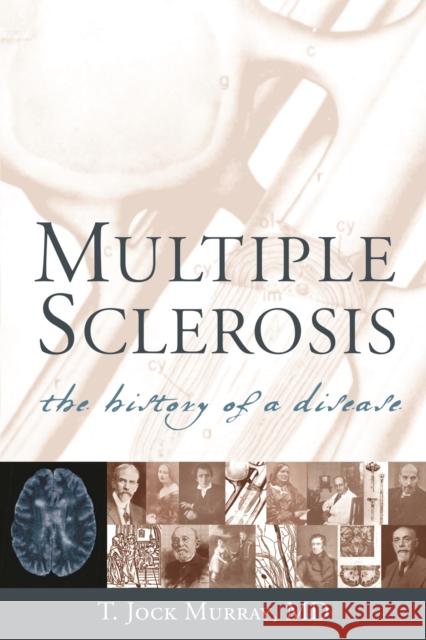 Multiple Sclerosis: The History of a Disease Murray, T. Jock 9781888799804 DEMOS MEDICAL PUBLISHING - książka