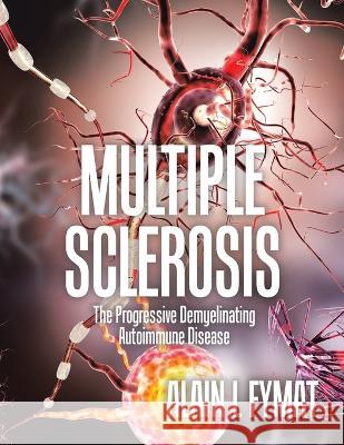 Multiple Sclerosis: The Progressive Demyelinating Autoimmune Disease Alain L. Fymat 9780228891413 Tellwell Talent - książka