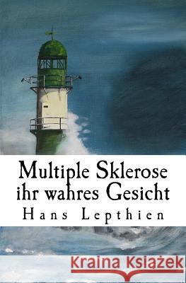 Multiple Sklerose ihr wahres Gesicht Lepthien, Hans Christian 9781522786542 Createspace Independent Publishing Platform - książka