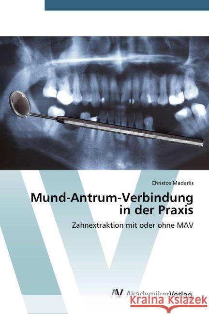 Mund-Antrum-Verbindung in der Praxis : Zahnextraktion mit oder ohne MAV Madarlis, Christos 9783639720464 AV Akademikerverlag - książka