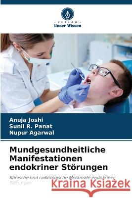 Mundgesundheitliche Manifestationen endokriner Störungen Joshi, Anuja, Panat, Sunil R., Agarwal, Nupur 9786209065903 Verlag Unser Wissen - książka