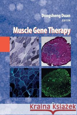 Muscle Gene Therapy Dongsheng Duan   9781489985248 Springer - książka