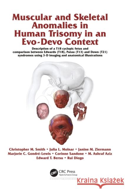 Muscular and Skeletal Anomalies in Human Trisomy in an Evo-Devo Context: Description of a T18 Cyclopic Fetus and Comparison Between Edwards (T18), Pat Rui Diogo Christopher M. Smith Janine M. Ziermann 9781498711371 CRC Press - książka