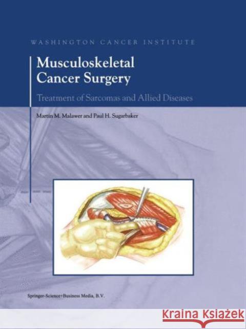 Musculoskeletal Cancer Surgery: Treatment of Sarcomas and Allied Diseases Malawer, Martin M. 9780792363941 Kluwer Academic Publishers - książka