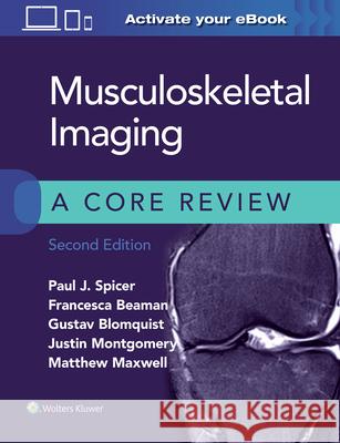 Musculoskeletal Imaging: A Core Review Paul Spicer 9781975120450 LWW - książka