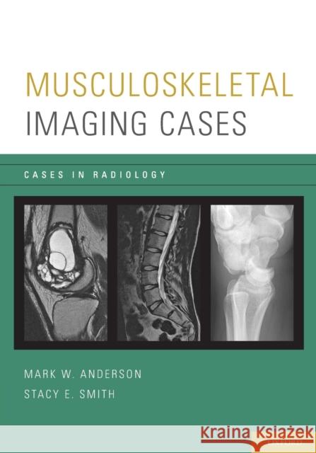 Musculoskeletal Imaging Cases Mark W. Anderson Stacy E. Smith 9780195394375 Oxford University Press, USA - książka