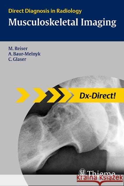 Musculoskeletal Imaging: Direct Diagnosis in Radiology Reiser, Maximilian 9783131451613 Thieme Publishing Group - książka