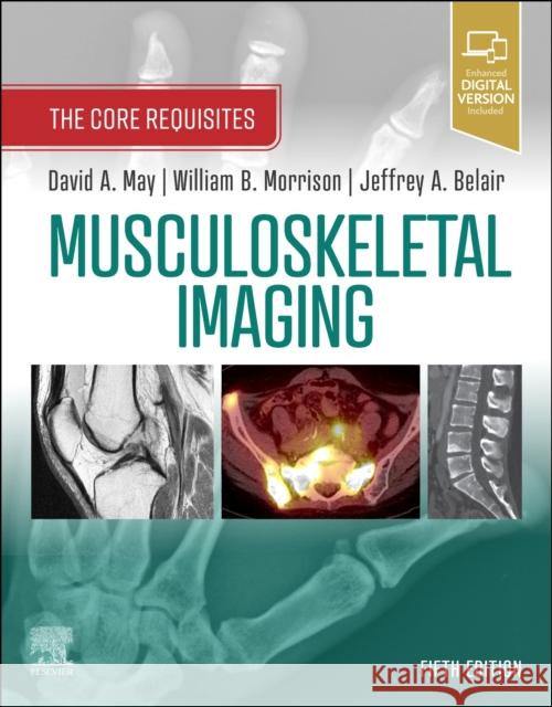 Musculoskeletal Imaging: The Core Requisites David A. May William B. Morrison Jeffrey A. Belair 9780323680592 Elsevier - Health Sciences Division - książka