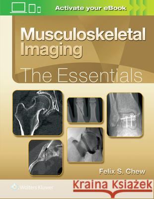 Musculoskeletal Imaging: The Essentials Felix S. Chew 9781496383839 Lippincott Williams and Wilkins - książka