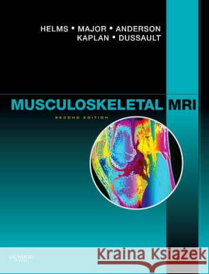 Musculoskeletal MRI Clyde A. Helms Nancy M. Major Mark W. Anderson 9781416055341 Saunders Book Company - książka