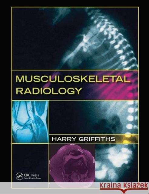 Musculoskeletal Radiology Harry Griffiths 9780367452612 Taylor and Francis - książka
