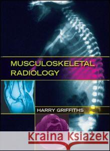 Musculoskeletal Radiology Griffiths Griffiths Harry Griffiths 9780849393907 Informa Healthcare - książka