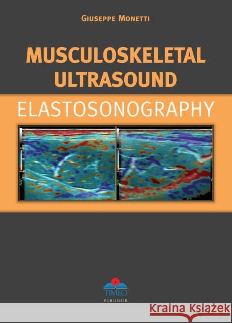 Musculoskeletal Ultrasound Elastosonography G Monetti 9788897162094 Timeo Editore SRL - książka