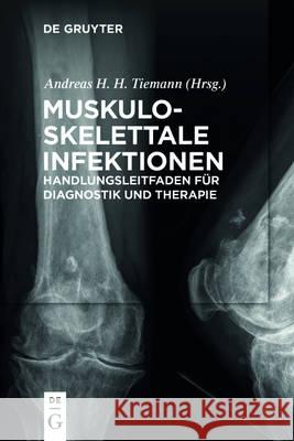Muskuloskelettale Infektionen Rainer Braunschweig, Lars Frommelt, Andreas Heinrich Tiemann 9783110473155 de Gruyter - książka