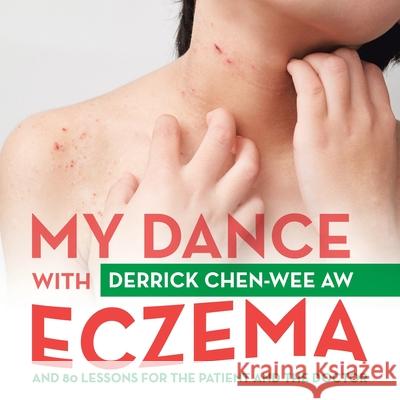 My Dance with Eczema: And 80 Lessons for the Patient and the Doctor Derrick Chen-We 9781543764116 Partridge Publishing Singapore - książka