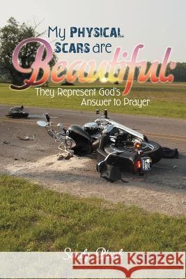 My Physical Scars Are Beautiful: They Represent God's Answer to Prayer Sandy, Blank 9781449774332 WestBow Press - książka