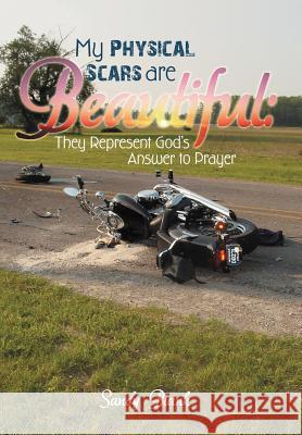 My Physical Scars Are Beautiful: They Represent God's Answer to Prayer Blank, Sandy 9781449774349 WestBow Press - książka