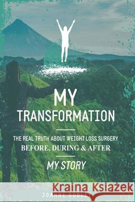 My Transformation...: The real truth about Weight Loss Surgery My story Joanne Godley 9781703739480 Independently Published - książka