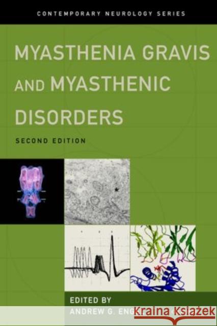 Myasthenia Gravis and Myasthenic Disorders Andrew G. Engel 9780199738670 Oxford University Press, USA - książka