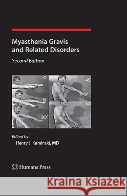 Myasthenia Gravis and Related Disorders Henry J. Kaminski 9781588298522 Humana Press - książka