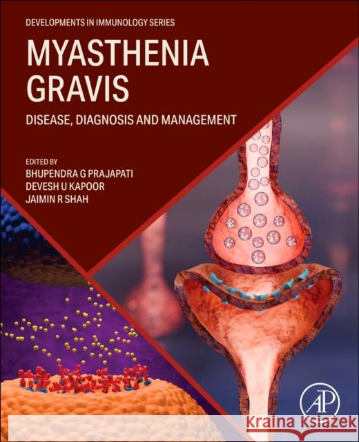 Myasthenia Gravis: Disease, Diagnosis and Management Bhupendra G. Prajapati Devesh U. Kapoor Jaimin R. Shah 9780443366475 Academic Press - książka