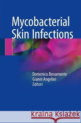 Mycobacterial Skin Infections Domenico Bonamonte Gianni Angelini 9783319485379 Springer - książka