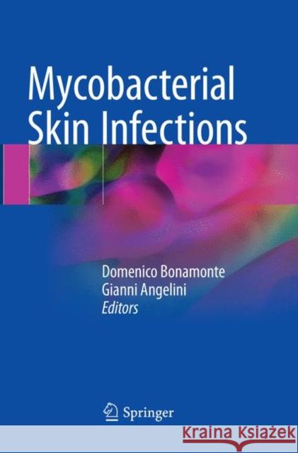 Mycobacterial Skin Infections Domenico Bonamonte Gianni Angelini 9783319839653 Springer - książka