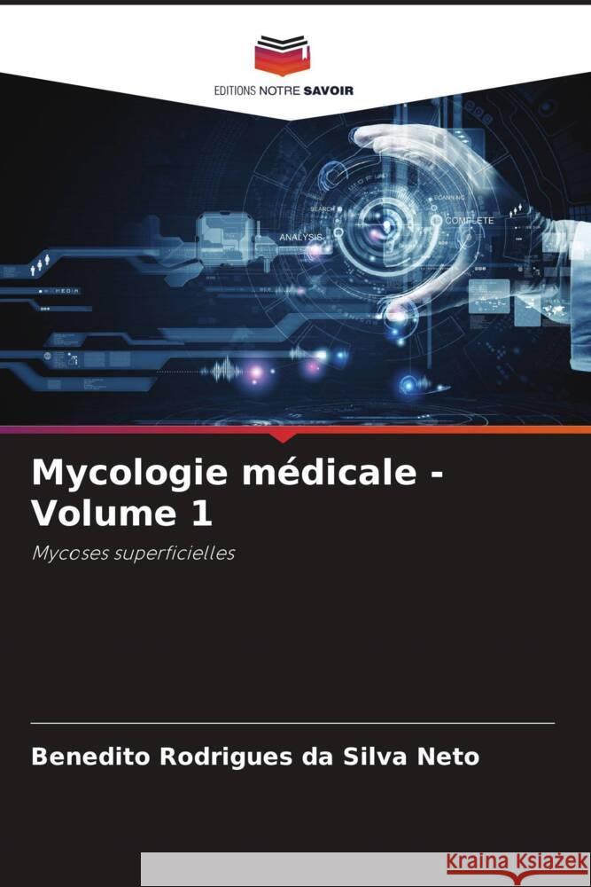 Mycologie médicale - Volume 1 Rodrigues da Silva Neto, Benedito 9786206357339 Editions Notre Savoir - książka