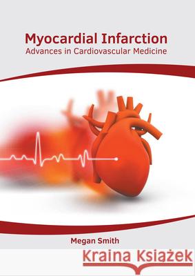 Myocardial Infarction: Advances in Cardiovascular Medicine Megan Smith 9781632419262 Hayle Medical - książka