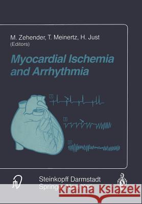 Myocardial Ischemia and Arrhythmia: Under the Auspices of the Society of Cooperation in Medicine and Science (Scms), Freiburg, Germany Zehender, M. 9783642725074 Steinkopff-Verlag Darmstadt - książka