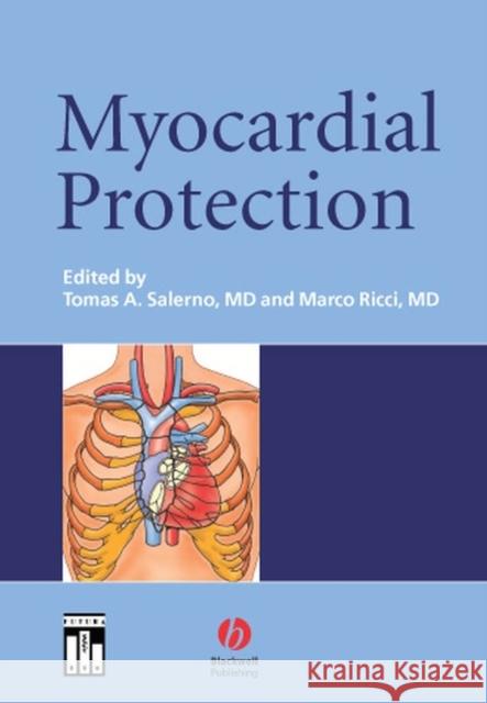 Myocardial Protection Marco Ricci Tomas Salerno Tomas A. Salerno 9781405116435 Blackwell/Futura - książka