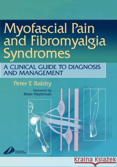 Myofascial Pain and Fibromyalgia Syndromes : A Clinical Guide to Diagnosis and Management P. E. Baldry Peter Baldry Muhammad B. Yunus 9780443070037 Churchill Livingstone - książka