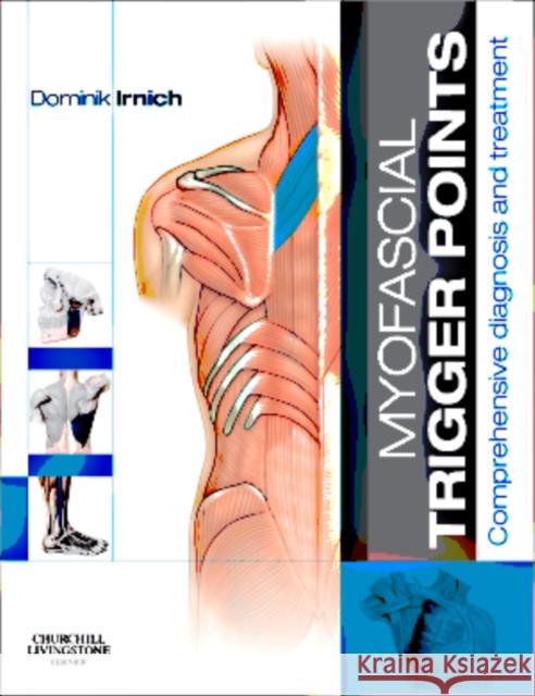 Myofascial Trigger Points : Comprehensive diagnosis and treatment Dominik Irnich 9780702043123 CHURCHILL LIVINGSTONE - książka