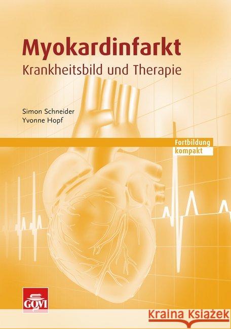 Myokardinfarkt : Krankheitsbild und Therapie Schneider, Simon; Hopf, Yvonne 9783774113534 Avoxa - książka