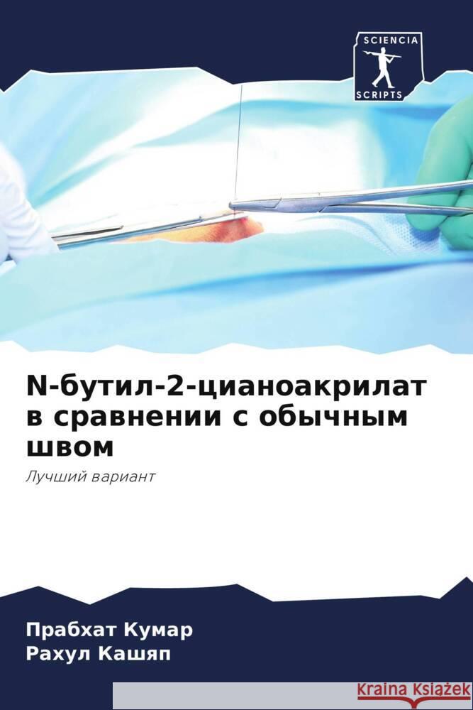 N-бутил-2-цианоакрилат в сравнении  Прабхат Кумар, Рахуl 9786205392348 Sciencia Scripts - książka