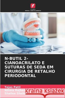 N-Butil 2-Cianoacrilato E Suturas de Seda Em Cirurgia de Retalho Periodontal Tejas Patil Nilima Rajhans Shailee Shelke 9786205799987 Edicoes Nosso Conhecimento - książka