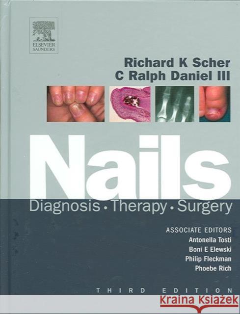 Nails: Diagnosis, Therapy, Surgery Scher, Richard K. 9781416023562 Saunders Book Company - książka