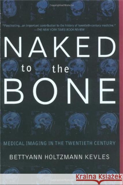 Naked to the Bone: Medical Imaging in the Twentieth Century Kevles, Bettyann Holtzmann 9780201328332 Perseus Books Group - książka