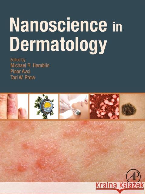 Nanoscience in Dermatology Michael Hamblin 9780128029268 ACADEMIC PRESS - książka