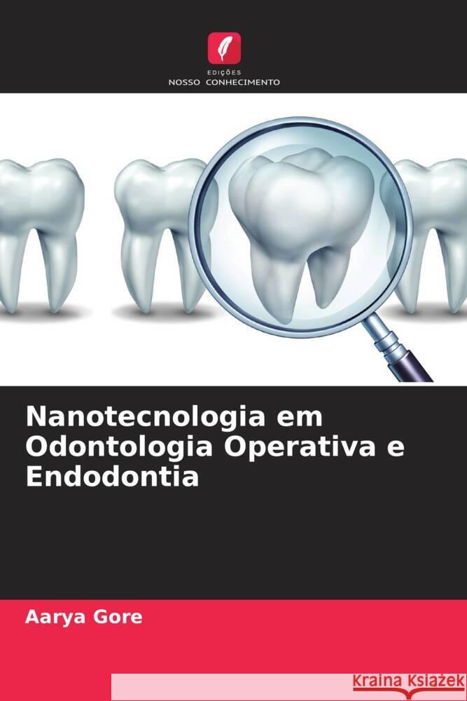 Nanotecnologia em Odontologia Operativa e Endodontia Gore, Aarya 9786204840772 Edições Nosso Conhecimento - książka