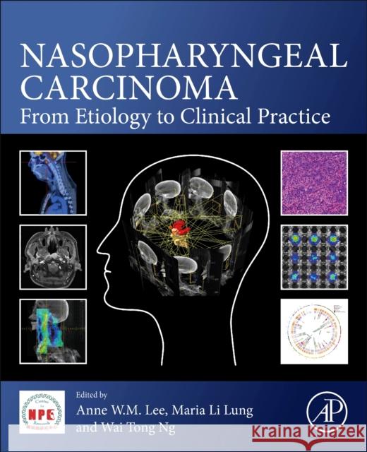 Nasopharyngeal Carcinoma: From Etiology to Clinical Practice Anne W. M. Lee Maria Li Lung Wai Tong Ng 9780128149362 Academic Press - książka