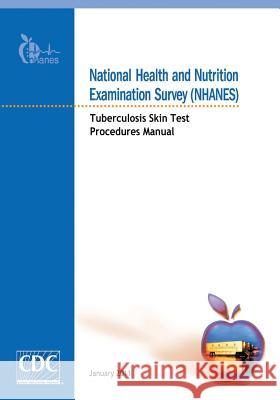 National Health and Nutrition Examination Survey (NHANES): Tuberculosis Skin Test Procedures Manual And Prevention, Centers for Disease Cont 9781499258769 Createspace - książka