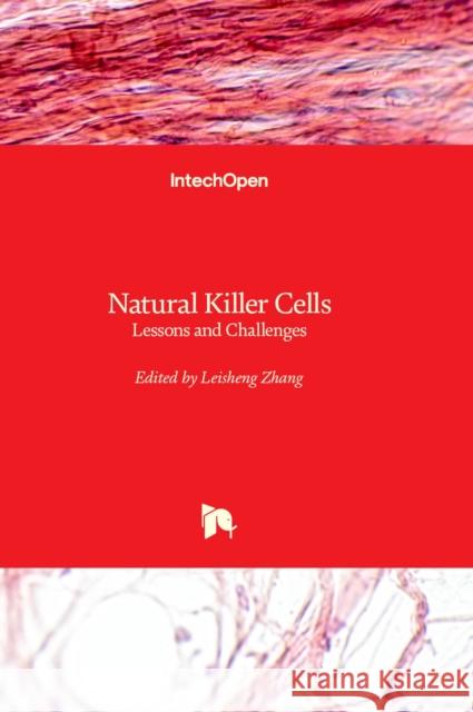 Natural Killer Cells: Lessons and Challenges Leisheng Zhang 9781837684809 IntechOpen - książka