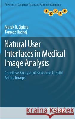 Natural User Interfaces in Medical Image Analysis: Cognitive Analysis of Brain and Carotid Artery Images Ogiela, Marek R. 9783319077994 Springer - książka