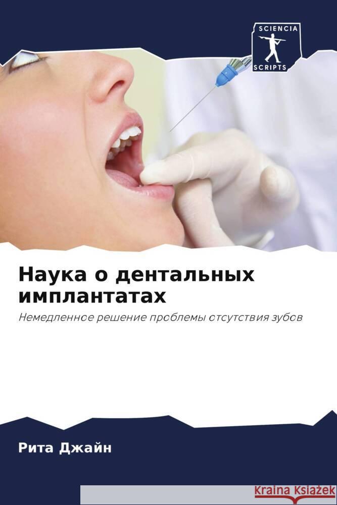 Nauka o dental'nyh implantatah Dzhajn, Rita 9786202954518 Sciencia Scripts - książka