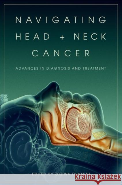Navigating Head and Neck Cancer: Advances in Diagnosis and Treatment Zodwa Dlamini 9780197794197 Oxford University Press - książka