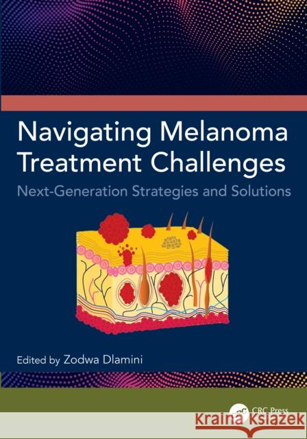 Navigating Melanoma Treatment Challenges: Next-Generation Strategies and Solutions Zodwa Dlamini 9781032841939 CRC Press - książka