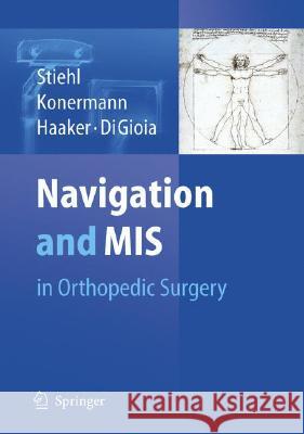 Navigation and MIS in Orthopedic Surgery James B. Stiehl Werner H. Konermann Rolf G. Haaker 9783540366904 Springer - książka